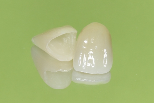 より天然歯に近い審美的な質感をご提供